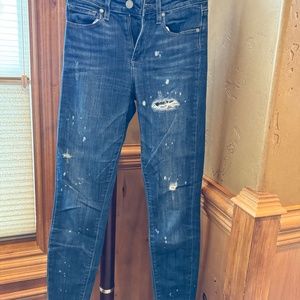 Paige Hoxton ankle peg leg